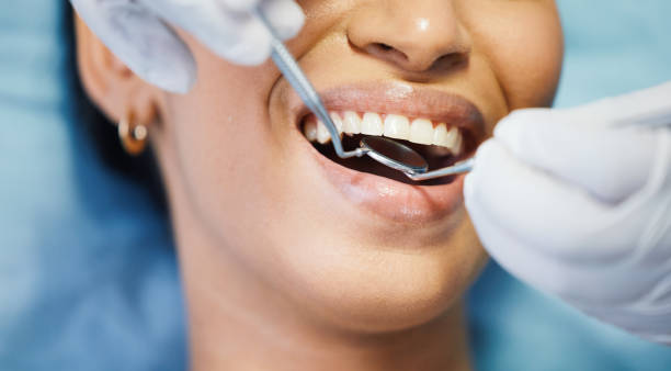 Best Emergency Gum Treatment in Ridgeway, AK